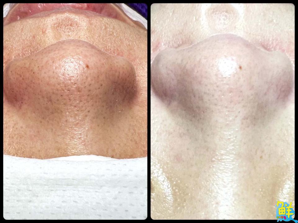 「忻」動不如馬上行動 讓 忻微美SPA美學 成為您預約美麗人生的起點