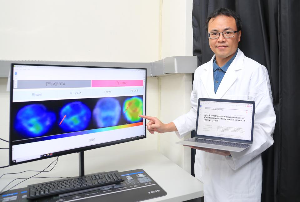中山大學生醫所孫羽佑跨國團隊開發神經疾病用藥變身探測顯影技術 榮登國際期刊