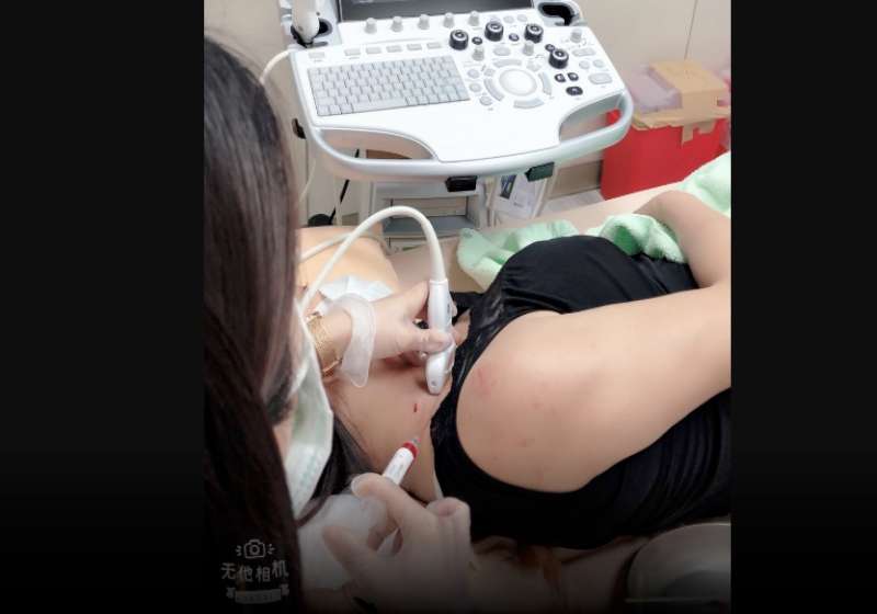 高雄中正脊椎骨科醫院超音波導引高濃度血小板注射 助頸腰椎損傷病友消除症狀