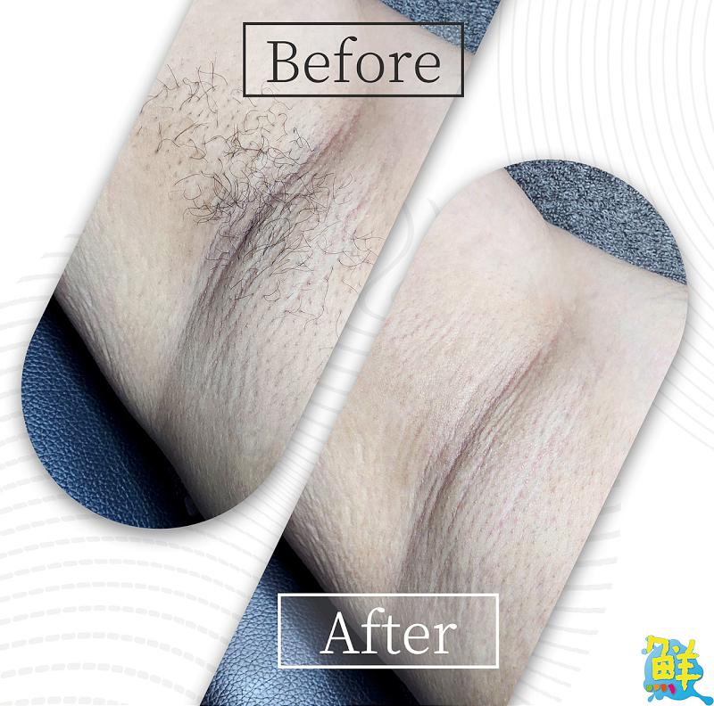 男性除毛市場新選擇 小資族創業夢起飛 馬魯沃斯熱蠟除毛