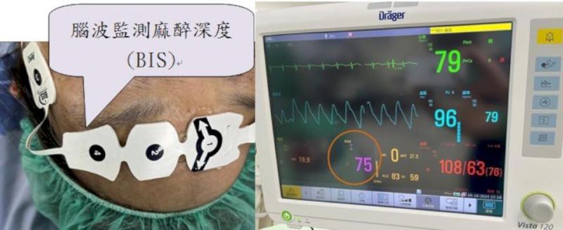民生醫院力推精準麻醉 完善心臟、胸腔、腦部手術病友醫療照護
