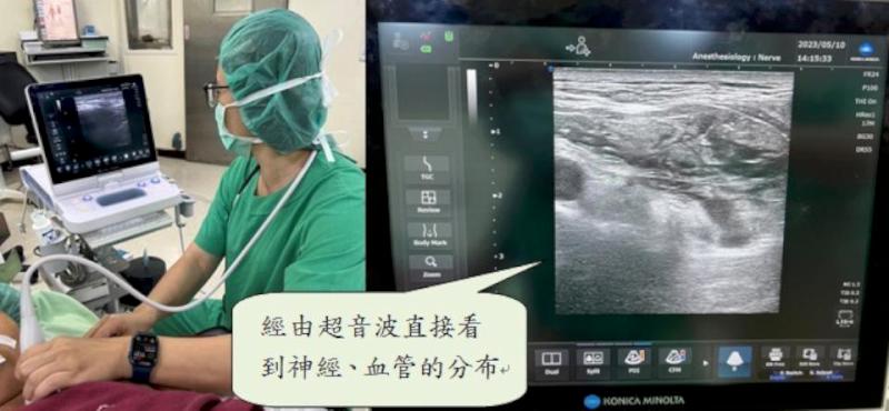 民生醫院力推精準麻醉 完善心臟、胸腔、腦部手術病友醫療照護