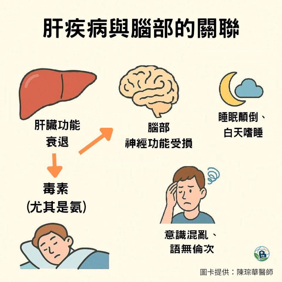 藝人沈玉琳傳猛爆性肝炎昏迷 高雄博田國際醫院神經內科提醒慎防肝性腦病變